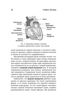 Хрупкие жизни. Истории кардиохирурга о профессии, где нет места сомнениям и страху — фото, картинка — 11