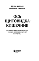 Ось щитовидка – кишечник. Как вылечить щитовидную железу, улучшив состояние кишечной микробиоты — фото, картинка — 2