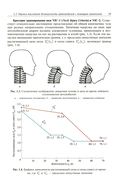 Активная система внутренней пассивной безопасности автомобиля — фото, картинка — 10
