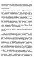 Ревматоидный артрит. Часть 2 — фото, картинка — 7