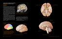 Большой атлас мозга — фото, картинка — 6